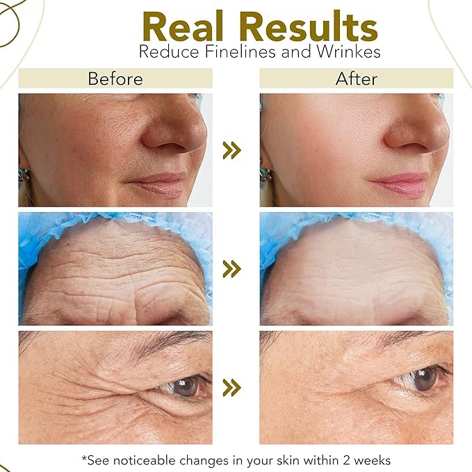 Nature’s Kinn Skincare Combo | Pure Radiance Brightening Serum + Dew All Day Hydrating Face Cream (30ml + 50g Combo Pack)