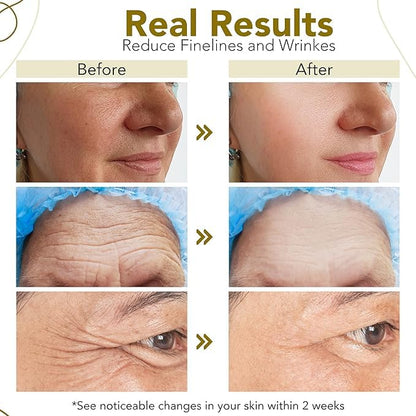 Nature’s Kinn Skincare Combo | Pure Radiance Brightening Serum + Dew All Day Hydrating Face Cream (30ml + 50g Combo Pack)