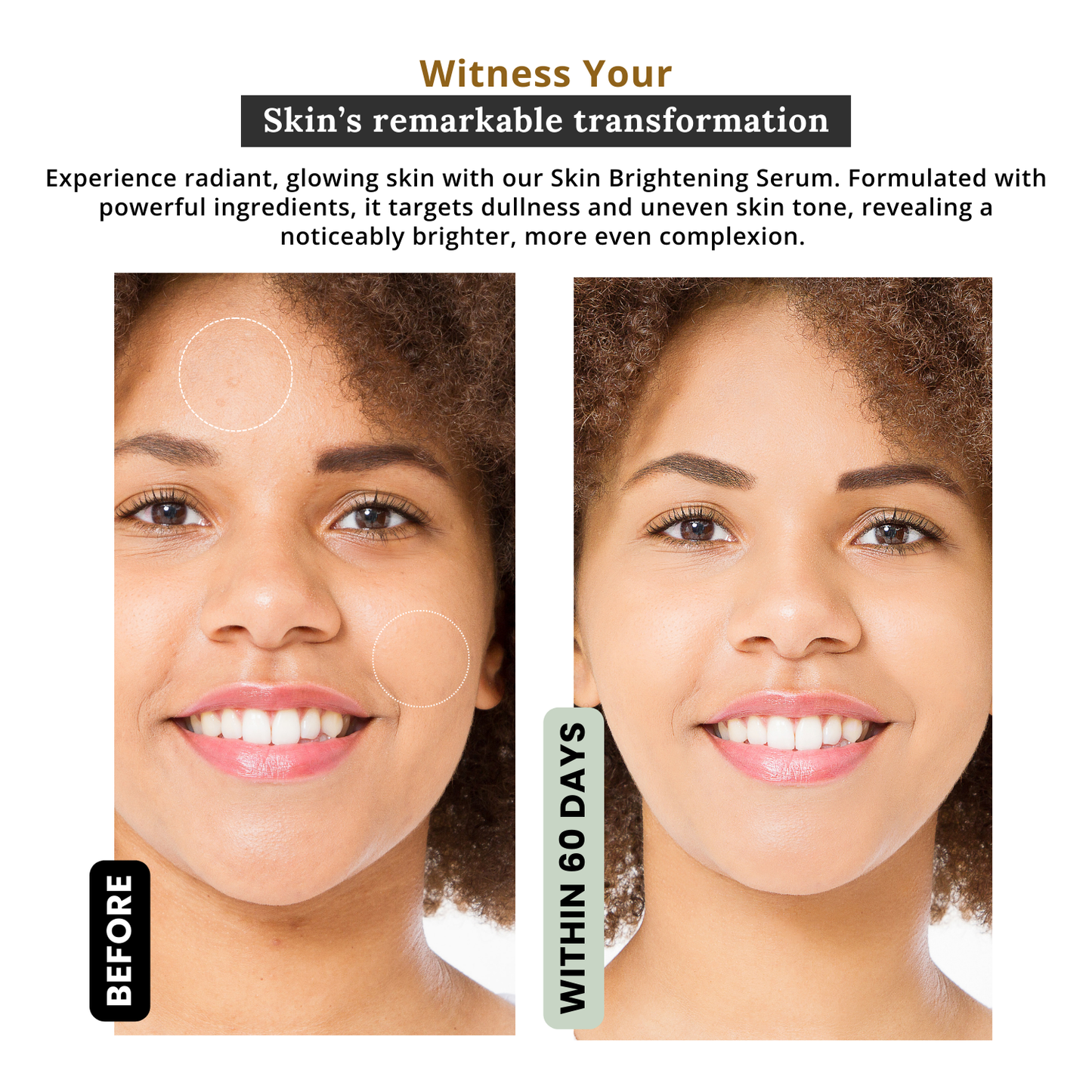 Pure Radiance - Lightening and Brightening Serum