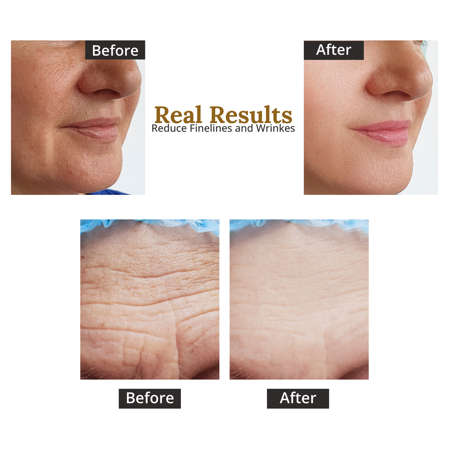 Advanced Age Renewal - Youth Restoration Serum