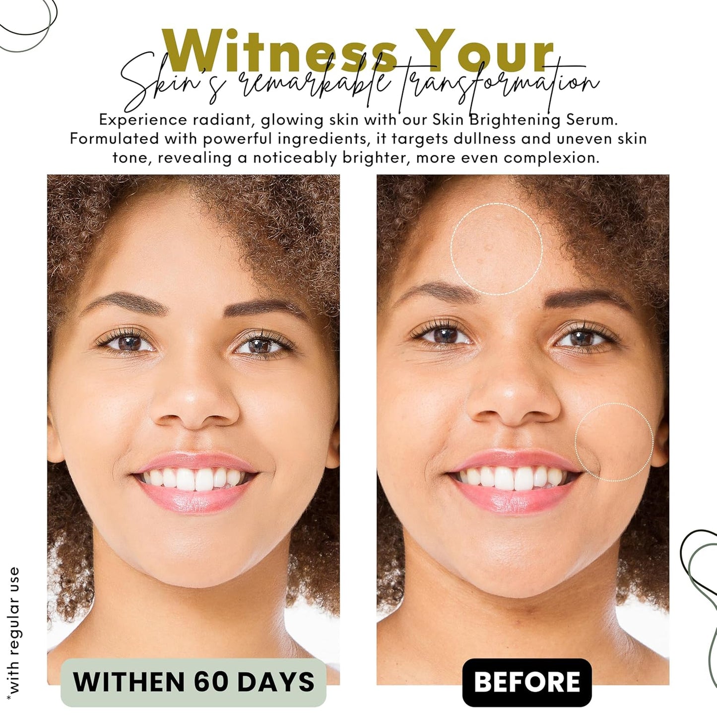 Nature’s Kinn Midnight Miracle Night Cream & Pure Radiance Serum Combo | 50gm + 30ml (Pack of 2)