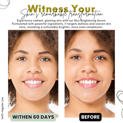 Nature’s Kinn Midnight Miracle Night Cream & Pure Radiance Serum Combo | 50gm + 30ml (Pack of 2)